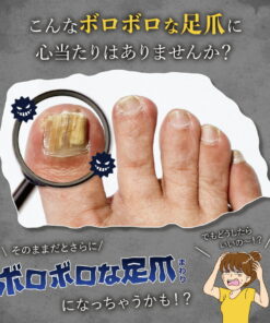 Alternative view of VIVIAN 维维安 指甲 杀菌 脚气 凝胶 乳霜 白癣菌 指甲碎裂 凹凸不平 男士护理 指定医药部外品 指甲周围消毒凝胶 药用 脚趾甲 指甲问题 杀菌 细菌 消毒 指甲周围护理